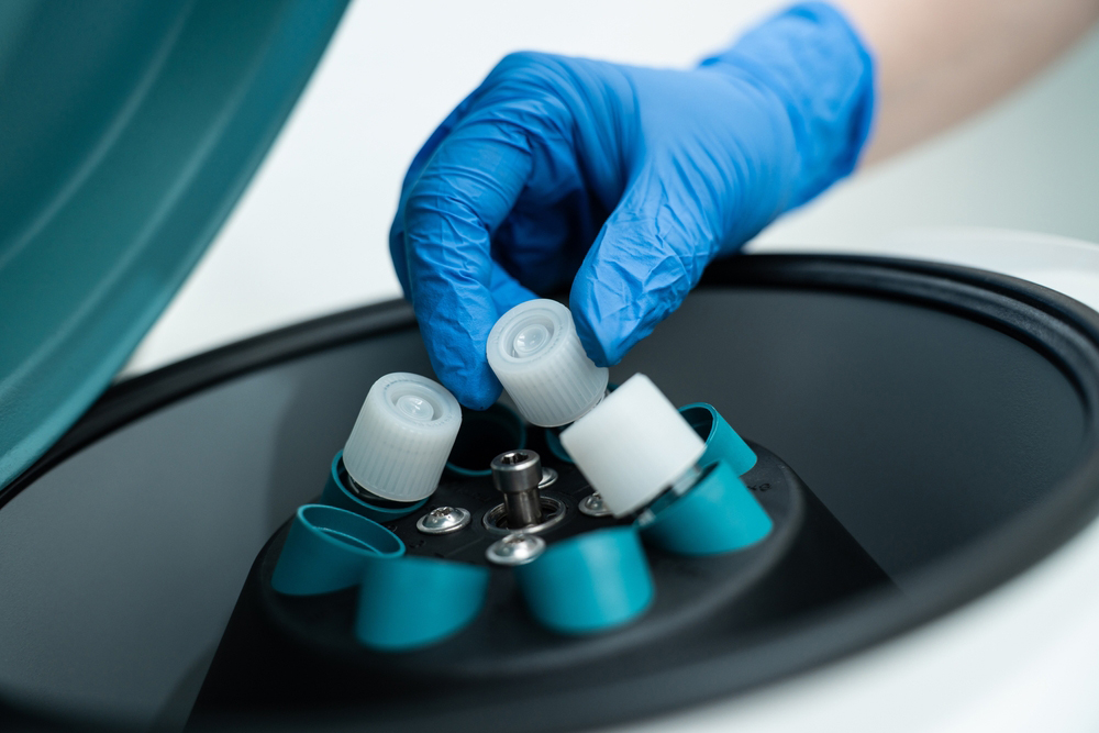 Trattamenti per l’infertilità di coppia